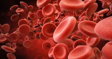 fresh frozen plasma, swelling attacks