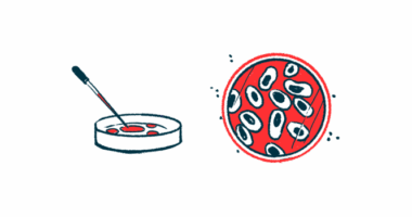 CAMP4 Therapeutics | Angioedema News | Illustration of cells in petri dish
