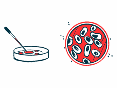 CAMP4 Therapeutics | Angioedema News | Illustration of cells in petri dish