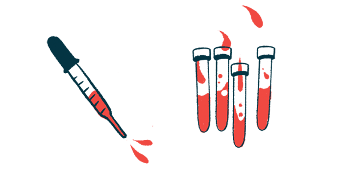 A dropper is seen squirting blood alongside four half-filled vials.