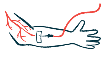 This illustration shows an intravenous or into-the-vein infusion being administered via a patient's right arm.