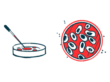 Cells are shown in a petri dish.