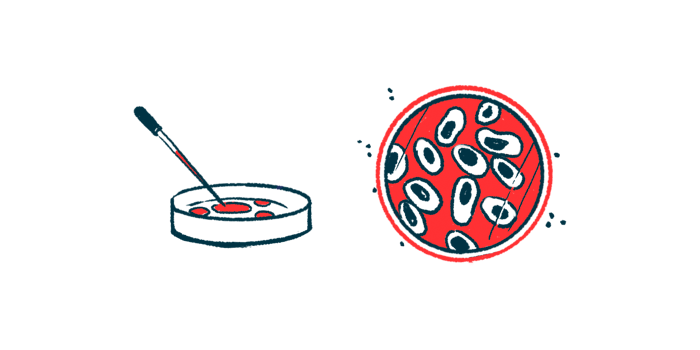 Cells are shown in a petri dish.