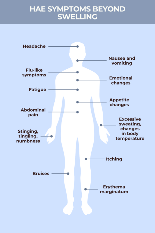 Non-swelling symptoms of HAE infographic
