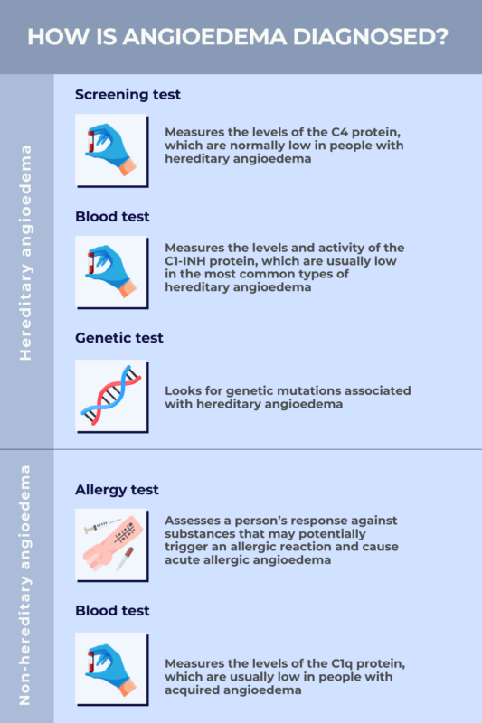 infographic detailing how angioedema is diagnosed