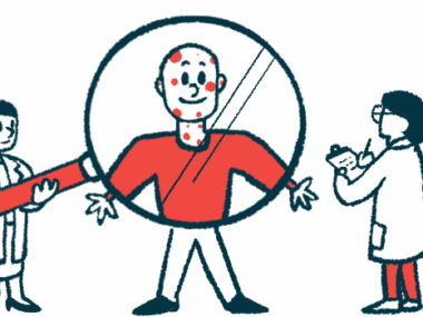 In this case study illustration, one clinician holds a gigantic magnifying glass in front of a patient with a rash on their head and neck while another takes notes on a clipboard.