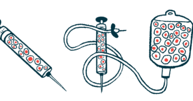 An illustration shows equipment used to administer stem cell therapy.