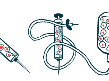 An illustration shows equipment used to administer stem cell therapy.