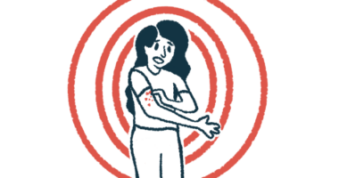 Illustration of woman with red marks or hives on her arm.