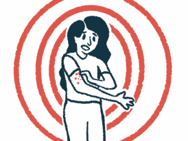 Illustration of woman with red marks or hives on her arm.