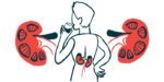 A person is shown from behind as they drink from a glass, with their kidneys highlighted in their lower back and oversized illustrations of kidneys flanking them.